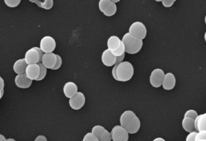 Pediococcus RT PCR kit