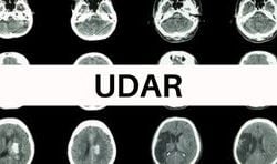 Udar_1 (1)