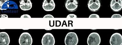 Udar_1 (1)